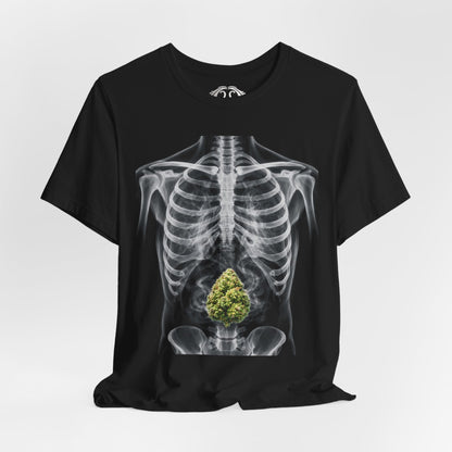 X-Ray Anatomy Tee with Green Bud Graphic —  T-Shirt