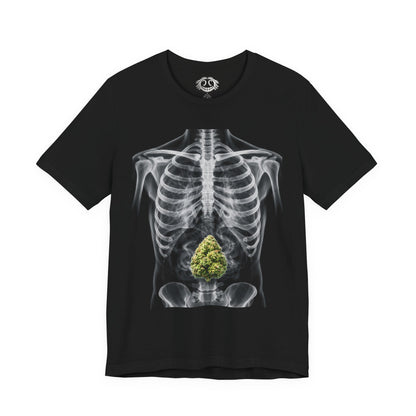 X-Ray Anatomy Tee with Green Bud Graphic —  T-Shirt